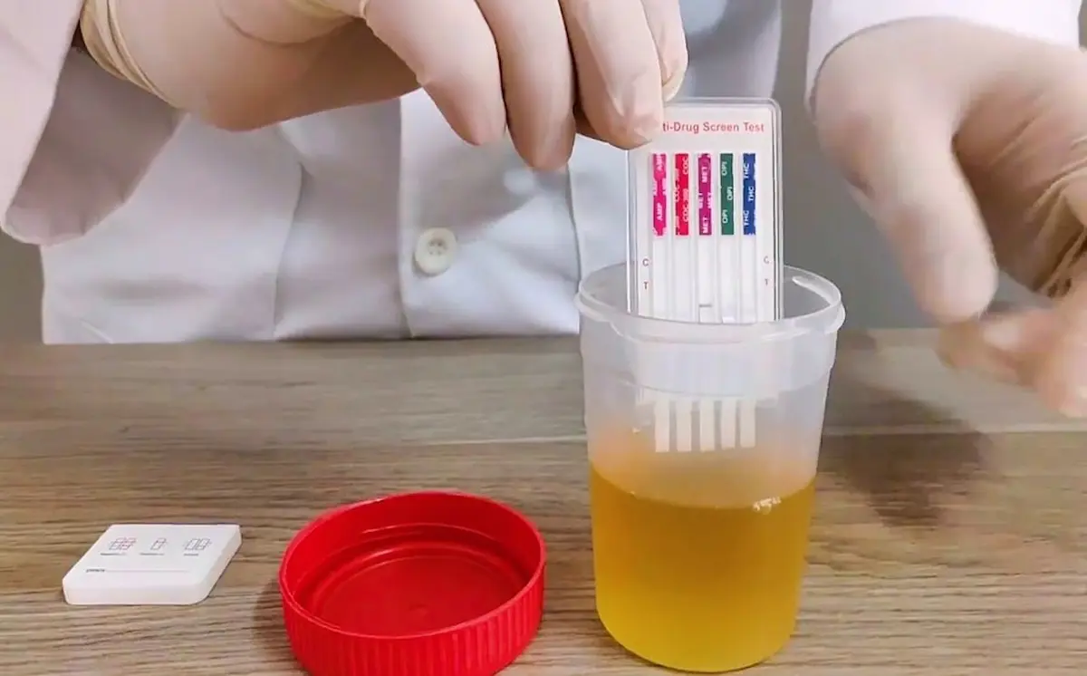 Antes de pedir el voto, candidatos del 2027 tendrían que pasar prueba antidoping 